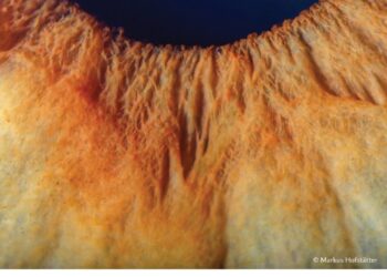 فوتوغرافيا – مجاهلُ العيون .. تفاصيلٌ وأسرار