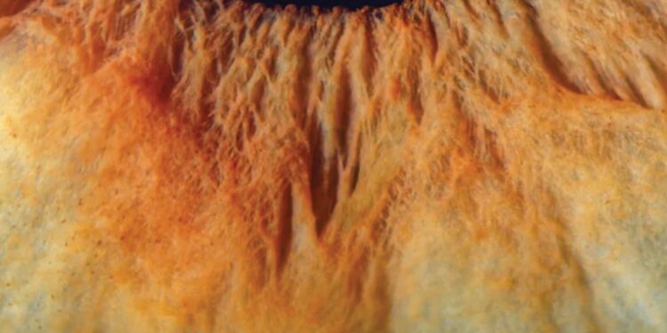 فوتوغرافيا – مجاهلُ العيون .. تفاصيلٌ وأسرار