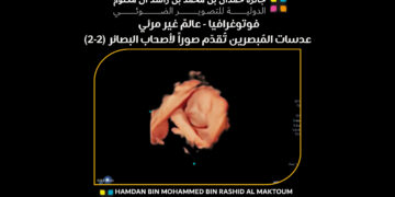 فوتوغرافيا  – عالمٌ غير مرئي – عدسات المُبصرين تُقدّم صوراً لأصحاب البصائر (2-2)